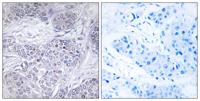 C/EBP γ Polyclonal Antibody