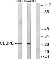 C/EBP δ/ε Polyclonal Antibody