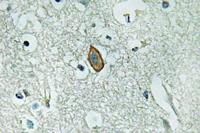 MaxiKα Polyclonal Antibody