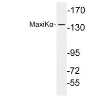 MaxiKα Polyclonal Antibody