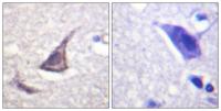 C/EBP ε Polyclonal Antibody