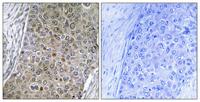 C/EBP ζ Polyclonal Antibody