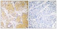 C1INH Polyclonal Antibody