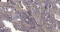 C1orf181 Polyclonal Antibody
