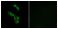 C1q-B Polyclonal Antibody
