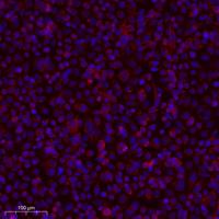C1QBP Polyclonal Antibody