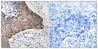 C1QBP Polyclonal Antibody