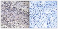 C1q-C Polyclonal Antibody
