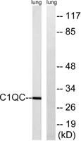 C1q-C Polyclonal Antibody