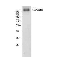 C4a/b Polyclonal Antibody