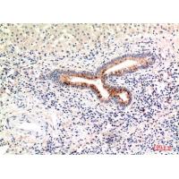 C4a/b Polyclonal Antibody