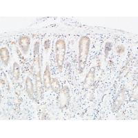 C4a/b Polyclonal Antibody