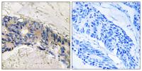 CA I Polyclonal Antibody