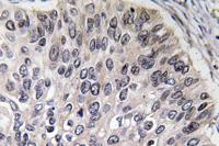 CA II Polyclonal Antibody