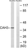 CA III Polyclonal Antibody