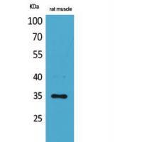 CA IV Polyclonal Antibody