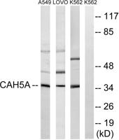 CA VA Polyclonal Antibody
