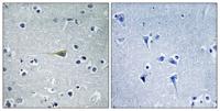 CA VB Polyclonal Antibody