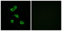 CA VB Polyclonal Antibody