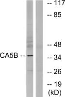 CA VB Polyclonal Antibody