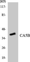 CA VB Polyclonal Antibody