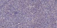 CA VIII Polyclonal Antibody