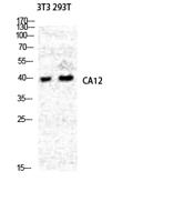 CA XII Polyclonal Antibody