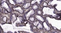 CA XII Polyclonal Antibody