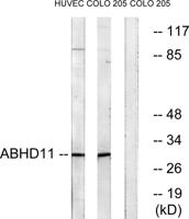 ABHD11 Polyclonal Antibody
