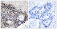 ABHD12B Polyclonal Antibody
