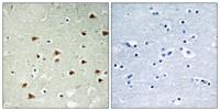 ABHD14B Polyclonal Antibody