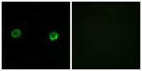 ABHD2 Polyclonal Antibody