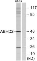 ABHD2 Polyclonal Antibody