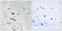 ABHD4 Polyclonal Antibody