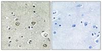 ABHD8 Polyclonal Antibody