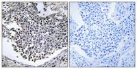 ABHD9 Polyclonal Antibody