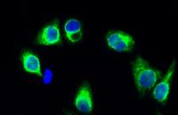 GluR-1 Polyclonal Antibody