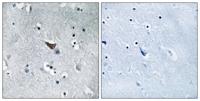 GluR-1 Polyclonal Antibody