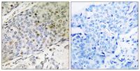 RMP Polyclonal Antibody