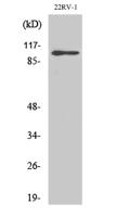 GluR-2 Polyclonal Antibody