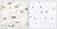 GluR-2 Polyclonal Antibody