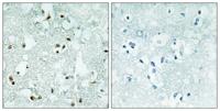 RNase Z2 Polyclonal Antibody