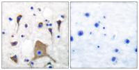 GluR-5 Polyclonal Antibody