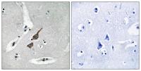 GluR-δ1 Polyclonal Antibody