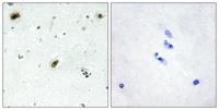 c-Abl Polyclonal Antibody