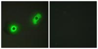 Cables2 Polyclonal Antibody