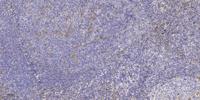 Cables2 Polyclonal Antibody