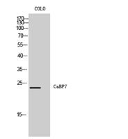 CaBP7 Polyclonal Antibody
