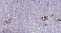 CaBP7 Polyclonal Antibody