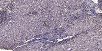 CAC1A Polyclonal Antibody